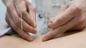 acupuncture pour l'ostéochondrose lombaire