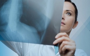 diagnostic de l'ostéochondrose cervicale